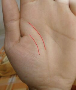 Đường sinh đạo là gì? Đặc điểm và ý nghĩa của nó là gì?